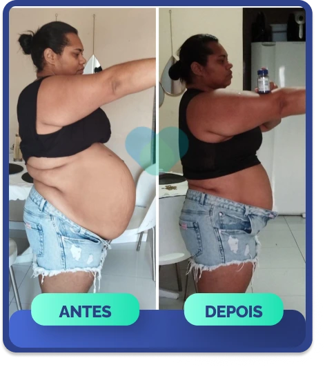nova antes e depois